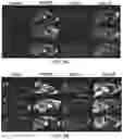 Fig. 23 - ENGINEERED ADENO-ASSOCIATED (AAV) VECTORS FOR TRANSGENE EXPRESSION