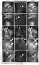 Fig. 24 - ENGINEERED ADENO-ASSOCIATED (AAV) VECTORS FOR TRANSGENE EXPRESSION