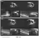 Fig. 28 - ENGINEERED ADENO-ASSOCIATED (AAV) VECTORS FOR TRANSGENE EXPRESSION