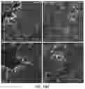 Fig. 33 - ENGINEERED ADENO-ASSOCIATED (AAV) VECTORS FOR TRANSGENE EXPRESSION