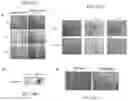 Fig. 04 - Replicative oncolytic adenovirus for regulating lipid metabolism and use thereof