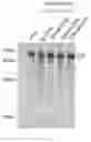 Fig. 346 - Crispr enzymes and systems