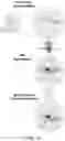 Fig. 11 - Analysis of multiple analytes using a single assay