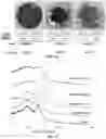 Fig. 10 - USE OF A PLURALITY OF SALT IONIC LIQUIDS IN THE PRETREATMENT OF BIOMASS