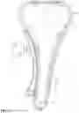 Fig. 02 - Tensioner