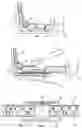 Fig. 02 - Device for obtaining accurate measurements from a flexible tape measure
