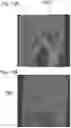 Fig. 14 - Method and apparatus for detecting a presence of a fluorescence pattern type on an organ section by means of immunofluorescence microscopy