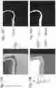 Fig. 15 - Method and apparatus for detecting a presence of a fluorescence pattern type on an organ section by means of immunofluorescence microscopy