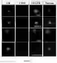 Fig. 10 - POLYPEPTIDE MAGNETIC NANOPARTICLE, PREPARATION METHOD THEREFOR AND USE THEREOF