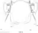Fig. 05 - Wearable, adjustable, hands-free binocular device