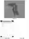 Fig. 04 - System and Method of Determining Shaping Parameters Based on Contact Line Motion