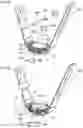 Fig. 08 - External fitting device and wristwatch