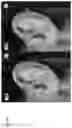 Fig. 20 - Technologies for virtually trying-on items