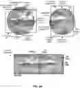 Fig. 05 - Wide-angle camera