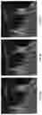Fig. 04 - Image super-resolution