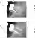 Fig. 05 - Automatic reduction of the appearance of Mach band effect on radiographs
