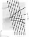 Fig. 05 - Method of and apparatus for creating an all-in-focus image of a portion of an iridocorneal angle of an eye