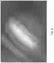 Fig. 06 - Method of and apparatus for creating an all-in-focus image of a portion of an iridocorneal angle of an eye