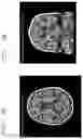 Fig. 10 - IMAGE ANALYSIS DEVICE, IMAGE ANALYSIS METHOD, AND IMAGE ANALYSIS PROGRAM