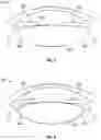 Fig. 03 - Augmentation of optical coherence tomography image of eye based on learning modules