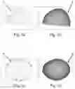 Fig. 04 - System for obtaining useful data for analysis of body morphometry and associated method