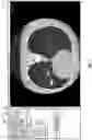 Fig. 04 - Systems and methods for detection and staging of pulmonary fibrosis from image-acquired data
