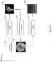 Fig. 03 - Method and device for extracting blood vessel wall