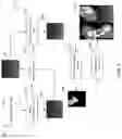 Fig. 05 - Method and device for extracting blood vessel wall