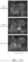 Fig. 16 - Systems and methods for transparent object segmentation using polarization cues