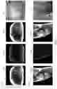 Fig. 12 - Deep learning systems and methods of removal of truncation artifacts in magnetic resonance images