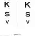 Fig. 23 - Light field display and vibrating light field shaping layer and vision testing and/or correction device