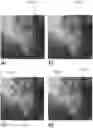 Fig. 01 - System and methods for augmenting X-ray images for training of deep neural networks
