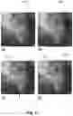 Fig. 06 - System and methods for augmenting X-ray images for training of deep neural networks