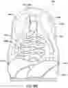 Fig. 08 - SYSTEMS AND METHODS FOR SURGICAL TRAINING