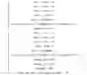 Fig. 15 - Classification of audio signal as speech or music based on energy fluctuation of frequency spectrum