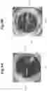 Fig. 10 - Light emitting sealed body, light emitting unit, and light source device