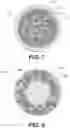 Fig. 05 - Scaffolding matrix with internal nanoparticles