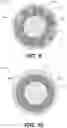 Fig. 06 - Scaffolding matrix with internal nanoparticles