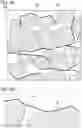Fig. 04 - Positive Electrode Active Material, Method for Manufacturing Positive Electrode Active Material, and Secondary Battery