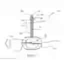 Fig. 16 - INSERTION DEVICE AND METHOD FOR DELIVERY OF A MESH CARRIER