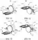 Fig. 05 - Adjustable mounting system for a telepresence device
