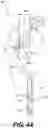 Fig. 08 - Medical device actuators