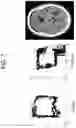 Fig. 08 - Methods and kits for assessing central nervous system integrity