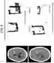 Fig. 09 - Methods and kits for assessing central nervous system integrity