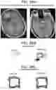 Fig. 32 - Methods and kits for assessing central nervous system integrity