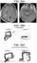 Fig. 35 - Methods and kits for assessing central nervous system integrity
