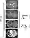 Fig. 43 - Methods and kits for assessing central nervous system integrity