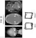 Fig. 44 - Methods and kits for assessing central nervous system integrity