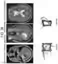 Fig. 45 - Methods and kits for assessing central nervous system integrity