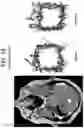 Fig. 46 - Methods and kits for assessing central nervous system integrity